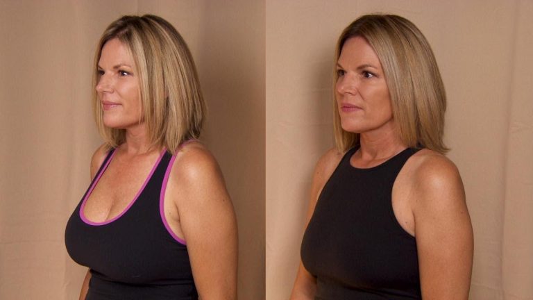 comment raffermir les seins