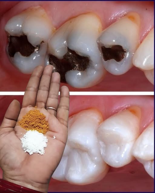 Dites adieu à la douleur dentaire