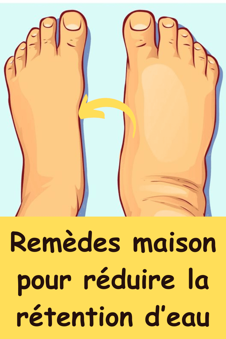 Œdème remedes naturelle