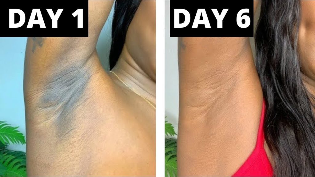 éclaircir les aisselles sombres